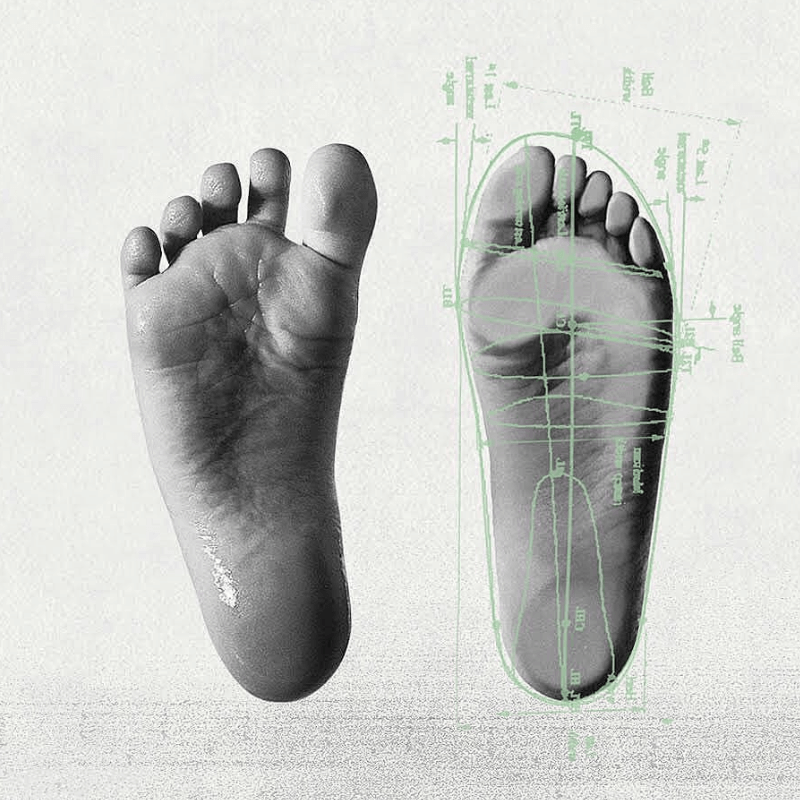 Orthopaedic toe separators